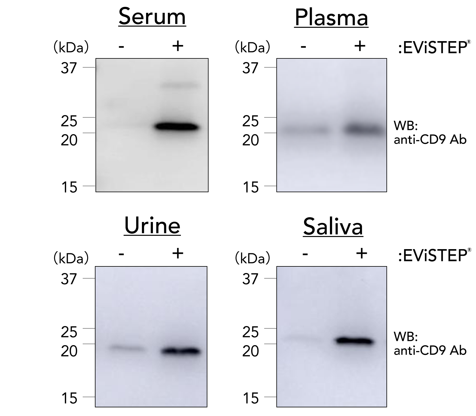 様々な検体種におけるEViSTEP&reg;でのEVsの回収